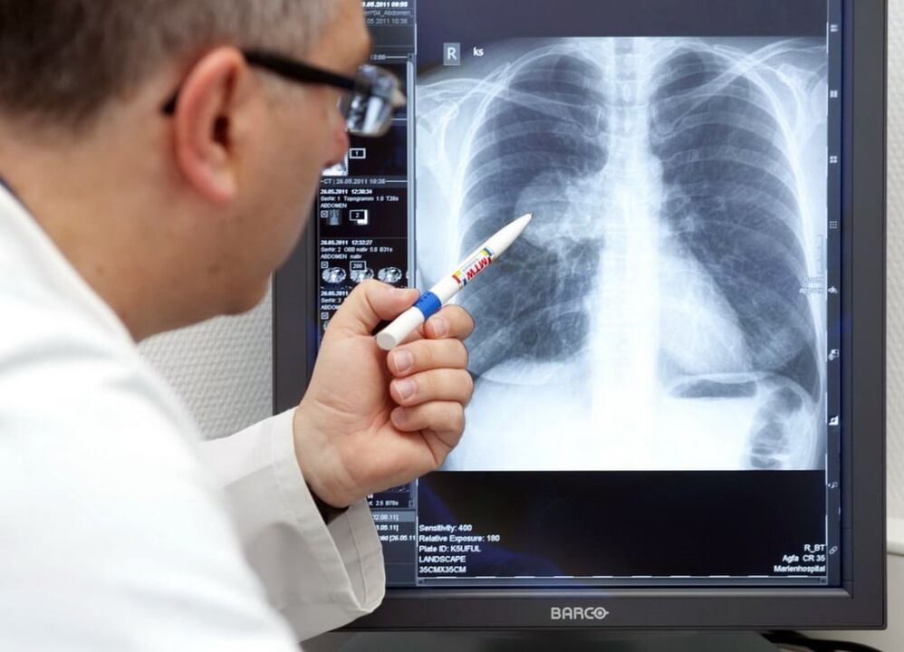 Diagnose von Bluthochdruck